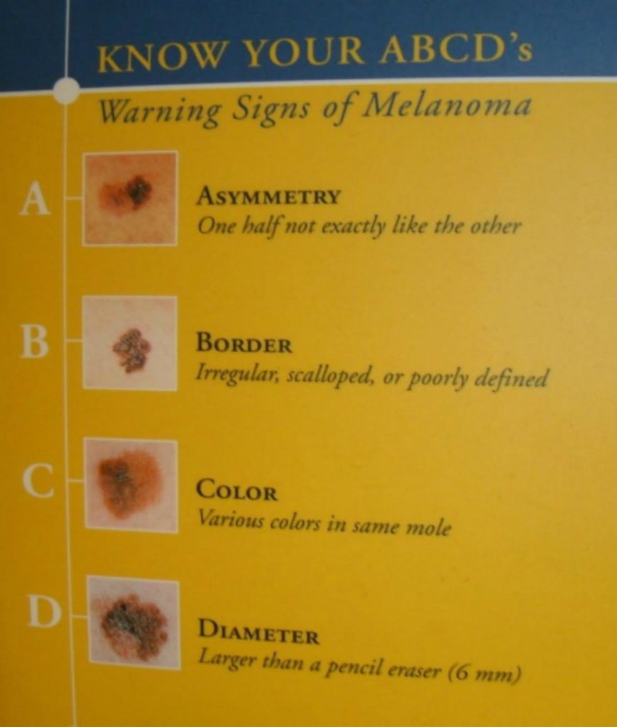 Melanoma Skin Cancer Still a Deadly Problem
